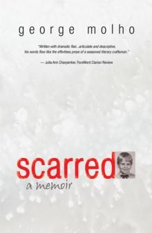 Scarred : A Memoir