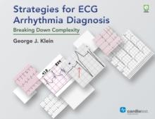 Strategies for ECG Arrhythmia Diagnosis : Breaking Down Complexity