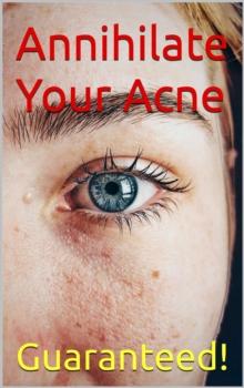 Annihilate Your Acne: How to Get Rid of Acne and Create Beautiful, Clear Skin; Your Easy, Proven Plan to Get Rid of Acne Fast