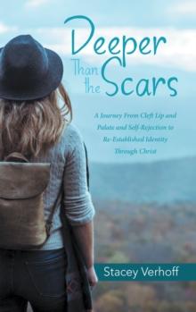 Deeper Than the Scars : A Journey from Cleft Lip and Palate and Self-Rejection to Re-Established Identity Through Christ