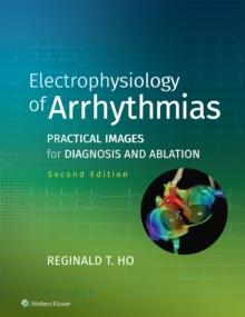 Electrophysiology of Arrhythmias : Practical Images for Diagnosis and Ablation