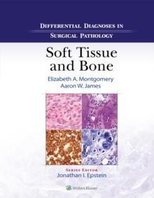 Differential Diagnoses in Surgical Pathology: Soft Tissue and Bone