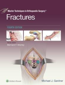 Master Techniques in Orthopaedic Surgery: Fractures