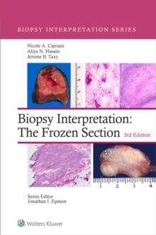 Biopsy Interpretation: The Frozen Section