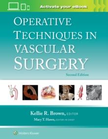 Operative Techniques in Vascular Surgery