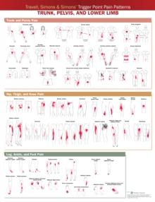 Travell, Simons & Simons Trigger Point Pain Patterns Wall Chart : Trunk, Pelvis, and Lower Limb