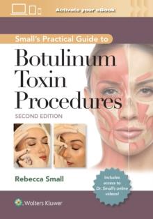 Small's Practical Guide to Botulinum Toxin Procedures