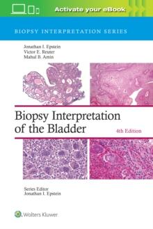 Biopsy Interpretation Of The Bladder: Print + eBook With Multimedia