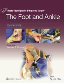 Master Techniques in Orthopaedic Surgery: The Foot and Ankle : eBook without Multimedia (Master Techniques in Orthopaedic Surgery)