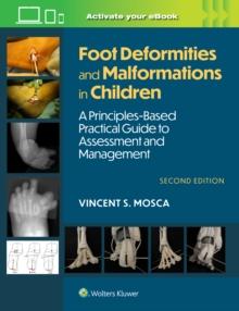 Foot Deformities and Malformations in Children : A Principles-Based, Practical Guide to Assessment and Management: Print + eBook with Multimedia