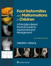 Foot Deformities and Malformations in Children : A Principles-Based, Practical Guide to Assessment and Management