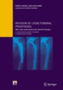 Revision of loose femoral prostheses with a stem system based on the "press-fit" principle : A concept and its system of implants, a method and its results