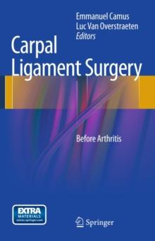 Carpal Ligament Surgery : Before Arthritis