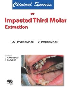 Clinical Success in Impacted Third Molar Extraction