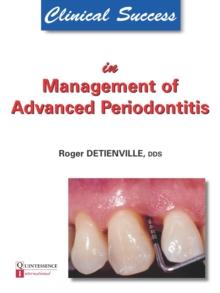 Clinical Success in Management of Advanced Periodontitis