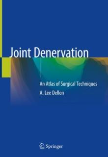 Joint Denervation : An Atlas of Surgical Techniques