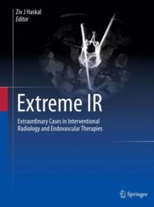 Extreme IR : Extraordinary Cases in Interventional Radiology and Endovascular Therapies