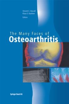 The Many Faces of Osteoarthritis