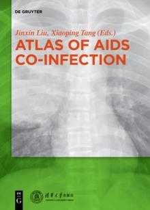 Atlas of AIDS Co-infection