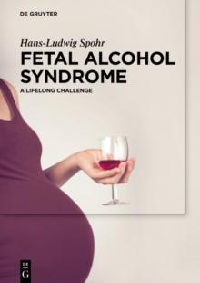 Fetal Alcohol Syndrome : A lifelong Challenge