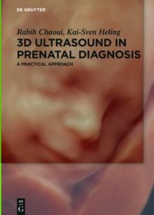 3D Ultrasound in Prenatal Diagnosis : A Practical Approach