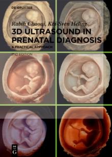 3D Ultrasound in Prenatal Diagnosis : A Practical Approach