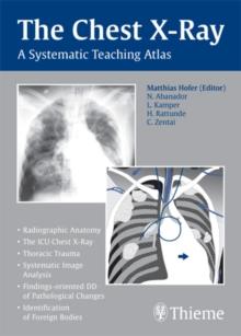 The Chest X-Ray : A Systematic Teaching Atlas