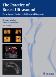 The Practice of Breast Ultrasound : Techniques, Findings, Differential Diagnosis