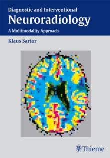 Diagnostic and Interventional Neuroradiology : A Multimodality Approach