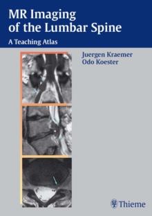 MR Imaging of the Lumbar Spine : A Teaching Atlas