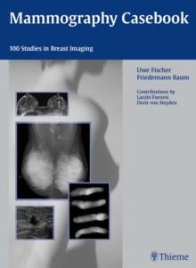 Mammography Casebook : 100 Studies in Breast Imaging