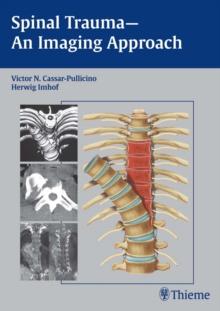 Spinal Trauma - An Imaging Approach