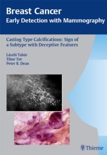 Breast Cancer: Early Detection with Mammography : Casting-Type Calcifications: Sign of a Subtype with Deceptive Features