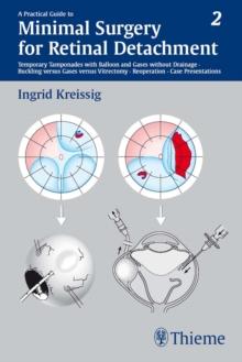 A Practical Guide to Minimal Surgery for Retinal Detachment, Vol. 2 : Temporary Tamponades with Balloon and Gases without Drainage, Buckling versus Gases versus Vitrectomy, Reoperation, Case Presentat