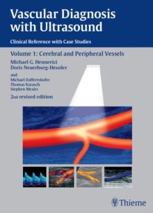 Vascular Diagnosis with Ultrasound : Clinical Reference with Case Studies Volume 1: Cerebral and Peripheral Vessels