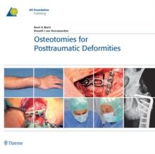 Osteotomies for Posttraumatic Deformities