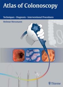 Atlas of Colonoscopy : Techniques - Diagnosis - Interventional Procedures