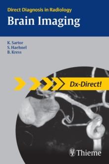 Brain Imaging : Direct Diagnosis in Radiology