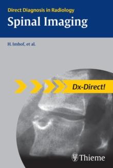 Spinal Imaging : Direct Diagnosis in Radiology