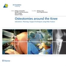 Osteotomies around the Knee : Indications - Planning - Surgical Techniques using Plate Fixators