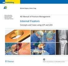 AO Manual of Fracture Management: Internal Fixators : Concepts and Cases using LCP and LISS