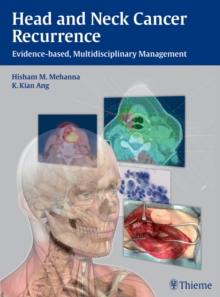 Head and Neck Cancer Recurrence : Evidence-based, Multidisciplinary Management