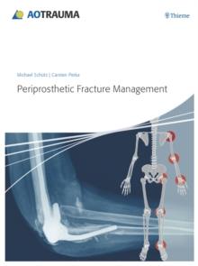 Periprosthetic Fracture Management