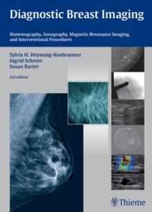 Diagnostic Breast Imaging : Mammography, Sonography, Magnetic Resonance Imaging, and Interventional Procedures