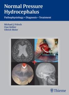 Normal Pressure Hydrocephalus : Pathophysiology - Diagnosis - Treatment