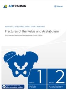 Fractures of the Pelvis and Acetabulum : Principles and Methods of Management