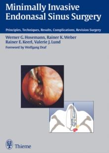 Minimally Invasive Endonasal Sinus Surgery : Principles, Techniques, Results, Complications, Revision Surgery