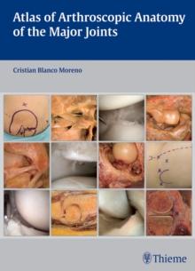 Atlas of Arthroscopic Anatomy of the Major Joints