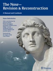 The Nose - Revision and Reconstruction : A Manual and Casebook