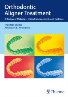 Orthodontic Aligner Treatment : A Review of Materials, Clinical Management, and Evidence